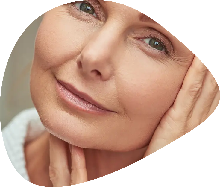 eliminar lineas de marioneta