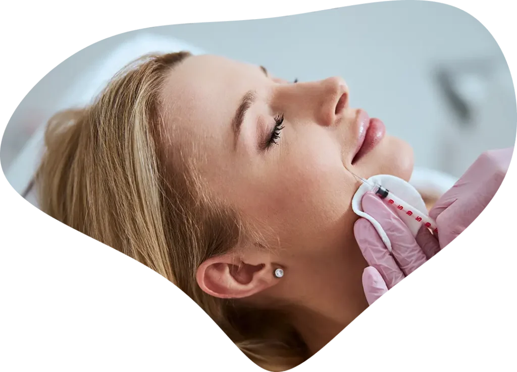 surco nasogeniano clinica estetica valladolid