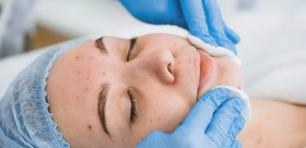 Tratamiento de limpieza facial profesional en Valladolid