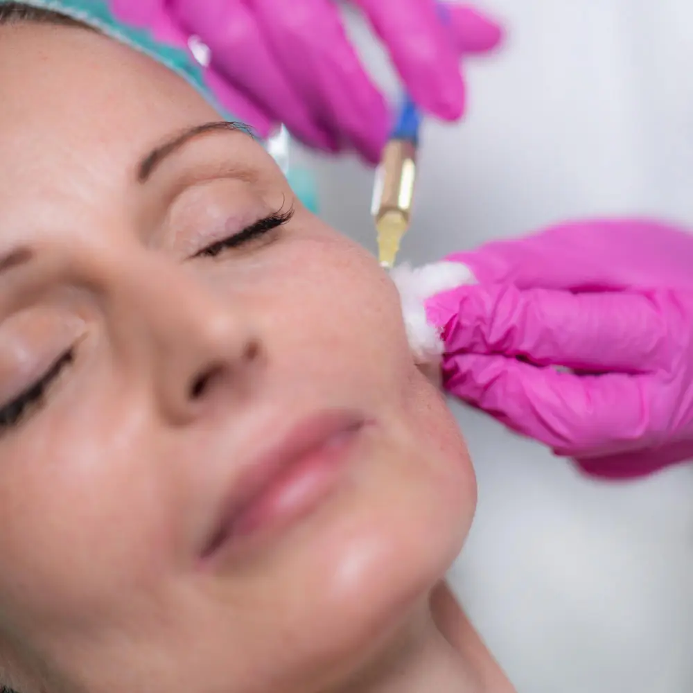 Carboxiterapia facial en Valladolid para mejorar la luminosidad y firmeza de la piel