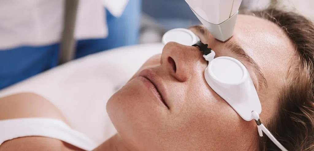 Láser facial en Valladolid para rejuvenecimiento y tratamientos de la piel