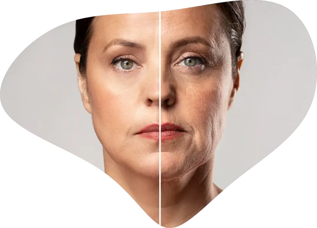 rejuvenecimiento facial sin cirugía en Valladolid en la clínica de medicina estética AJ Clinic de Dra. Andreina Jiméne