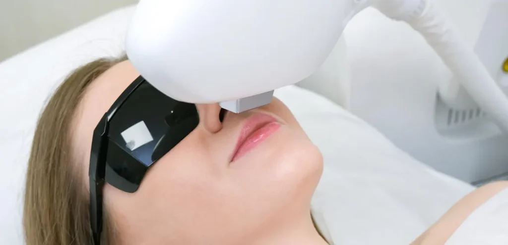 Tratamientos de láser facial en Valladolid