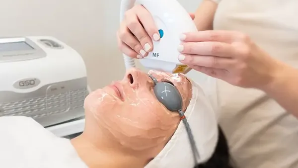 laser IPL valladolid