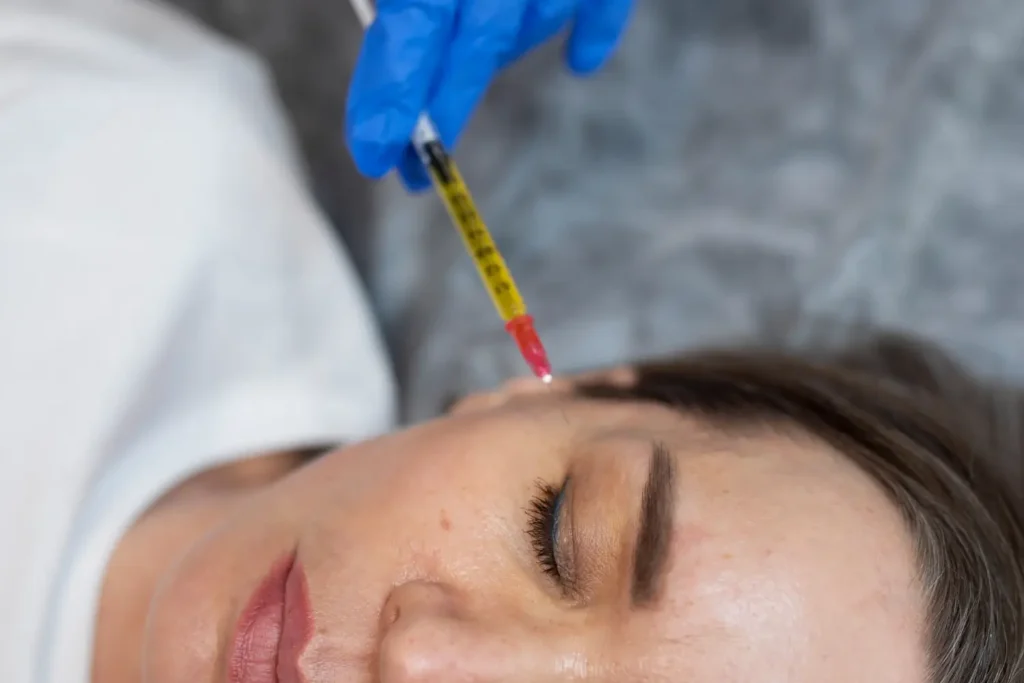 Aplicación de mesoterapia facial en Valladolid para mejorar la calidad y luminosidad de la piel