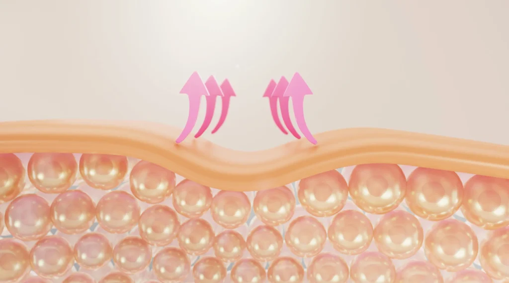 Tipos de polinucleótidos utilizados en tratamientos estéticos regenerativos