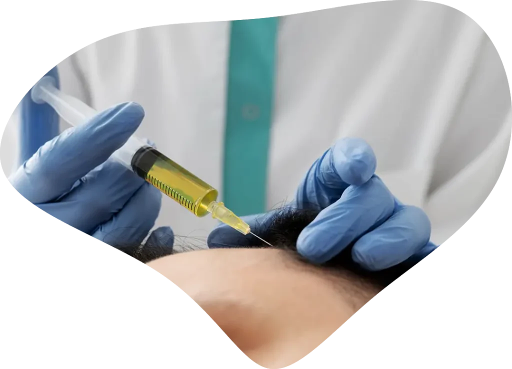 PRP capilar en Burgos