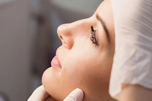 Tratamiento de arrugas de expresión con ácido hialurónico en Valladolid realizado por la Dra. Andreina Jiménez para rejuvenecer el rostro con resultados naturales.
