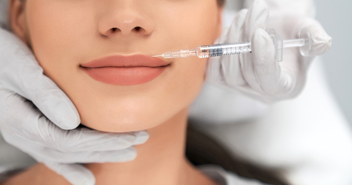 Tratamiento de aumento de labios con ácido hialurónico en Burgos realizado por la Dra. Andreina Jiménez